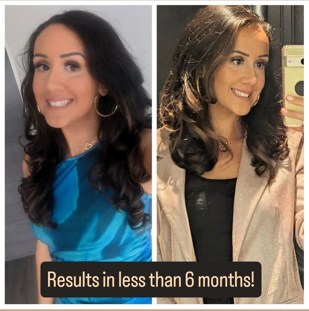 Hair Growth Oil Treatment