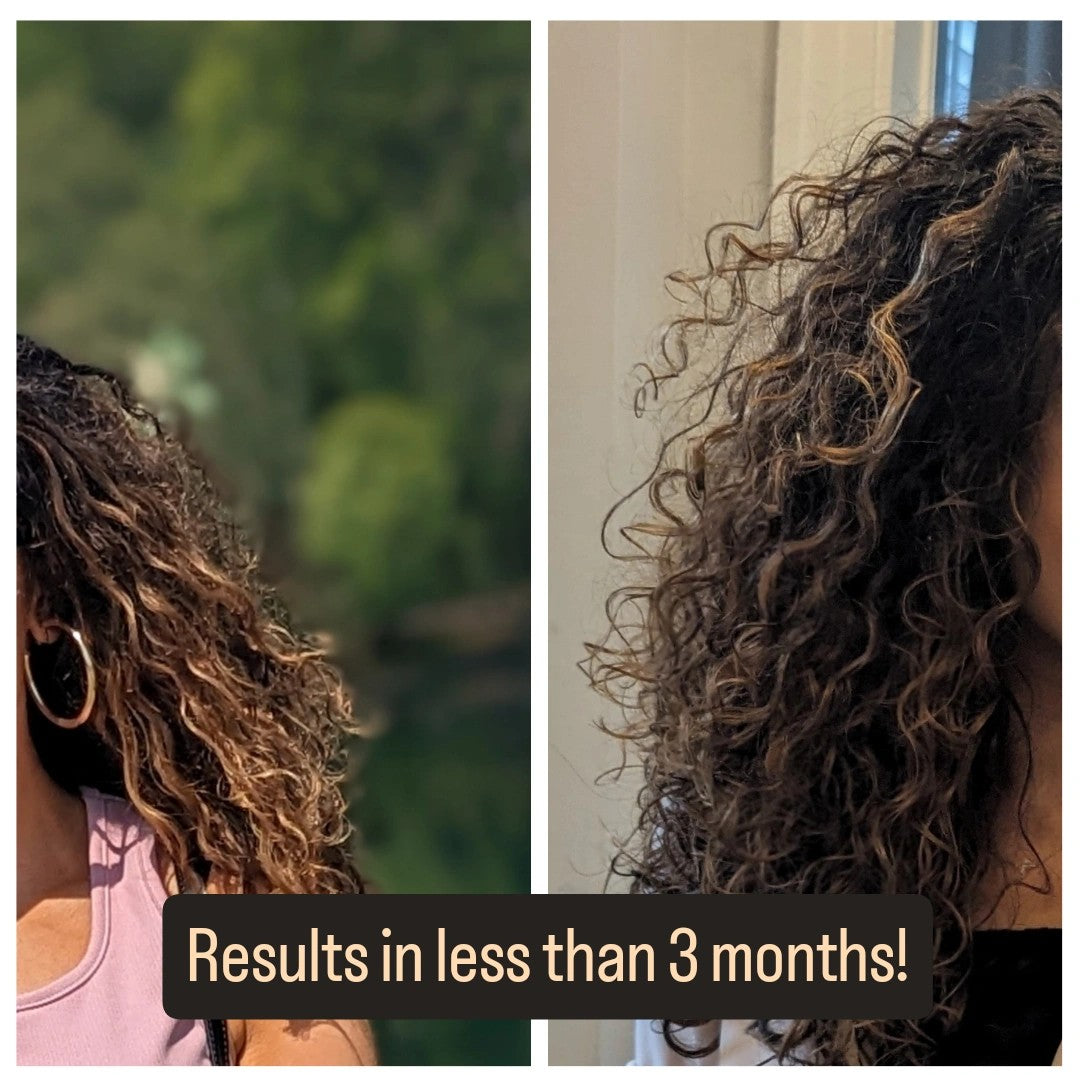 Hair Growth Oil Treatment